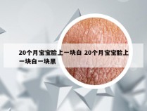 20个月宝宝脸上一块白 20个月宝宝脸上一块白一块黑