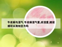 牛皮癣与湿气 牛皮癣湿气重,痰湿重,糖尿病可以用阳至方吗