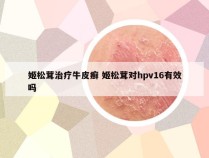 姬松茸治疗牛皮癣 姬松茸对hpv16有效吗