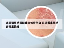 辽源银屑病医院我选长春华山 辽源看皮肤病去哪里最好