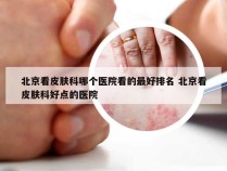北京看皮肤科哪个医院看的最好排名 北京看皮肤科好点的医院