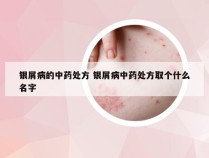 银屑病的中药处方 银屑病中药处方取个什么名字