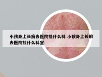 小孩身上长癣去医院挂什么科 小孩身上长癣去医院挂什么科室