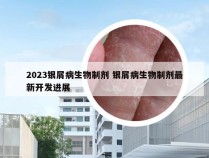 2023银屑病生物制剂 银屑病生物制剂最新开发进展