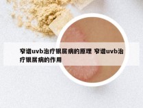 窄谱uvb治疗银屑病的原理 窄谱uvb治疗银屑病的作用