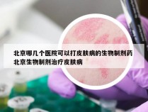 北京哪几个医院可以打皮肤病的生物制剂药 北京生物制剂治疗皮肤病