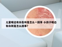 儿童嘴边有白色块是怎么一回事 小孩子嘴边有白斑是怎么回事?