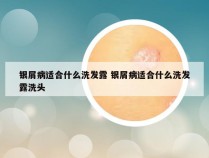 银屑病适合什么洗发露 银屑病适合什么洗发露洗头