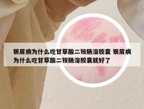 银屑病为什么吃甘草酸二铵肠溶胶囊 银屑病为什么吃甘草酸二铵肠溶胶囊就好了