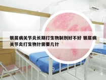 银屑病关节炎长期打生物制剂好不好 银屑病关节炎打生物针需要几针