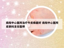 南阳中心医院治疗牛皮癣最好 南阳中心医院皮肤科主任医师