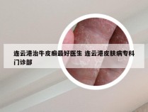 连云港治牛皮癣最好医生 连云港皮肤病专科门诊部