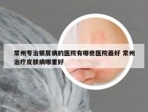 常州专治银屑病的医院有哪些医院最好 常州治疗皮肤病哪里好