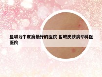 盐城治牛皮癣最好的医院 盐城皮肤病专科医医院