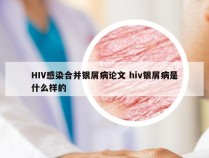 HIV感染合并银屑病论文 hiv银屑病是什么样的
