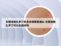 长期涂他扎罗汀乳膏会得银屑病么 长期涂他扎罗汀可以去痘坑吗