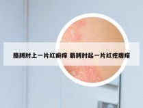 胳膊肘上一片红癣痒 胳膊肘起一片红疙瘩痒