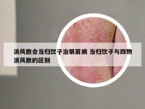 消风散合当归饮子治银屑病 当归饮子与四物消风散的区别