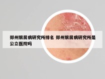 郑州银屑病研究所排名 郑州银屑病研究所是公立医院吗