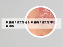 银屑病卡泊三醇组合 银屑病卡泊三醇可以一直用吗