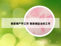 银屑病户外工作 银屑病适合的工作