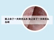 脸上白了一大块怎么办 脸上白了一大块怎么办啊
