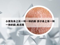 小朋友身上长一块一块的癣 孩子身上有一块一块的藓,有点痒