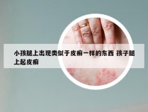小孩腿上出现类似于皮癣一样的东西 孩子腿上起皮癣