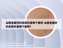 山西省最好的皮肤科是哪个医院 山西省最好的皮肤科是哪个医院?