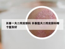 长春一大二院皮肤科 长春医大二院皮肤科哪个医生好
