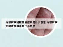 治银屑病的糖皮质激素是什么意思 治银屑病的糖皮质激素是什么意思