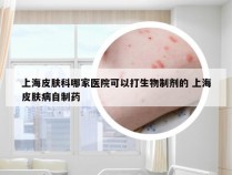 上海皮肤科哪家医院可以打生物制剂的 上海皮肤病自制药