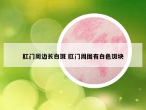 肛门周边长白斑 肛门周围有白色斑块