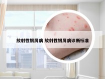 放射性银屑病 放射性银屑病诊断标准
