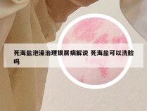 死海盐泡澡治理银屑病解说 死海盐可以洗脸吗