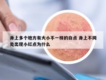 身上多个地方有大小不一样的白点 身上不同处出现小红点为什么