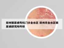 郑州银屑病专科门诊金水区 郑州市金水区银屑病研究所咋样