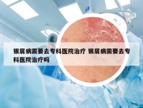 银屑病需要去专科医院治疗 银屑病需要去专科医院治疗吗