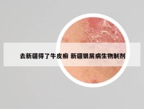 去新疆得了牛皮癣 新疆银屑病生物制剂