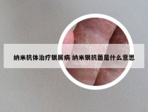 纳米抗体治疗银屑病 纳米银抗菌是什么意思