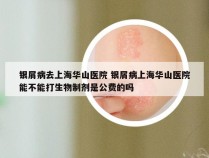 银屑病去上海华山医院 银屑病上海华山医院能不能打生物制剂是公费的吗