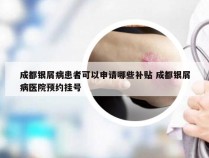 成都银屑病患者可以申请哪些补贴 成都银屑病医院预约挂号