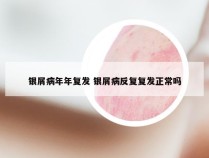 银屑病年年复发 银屑病反复复发正常吗