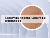 小蓬草治牛皮癣的用量用法 小蓬草治牛皮癣的用量用法是多少