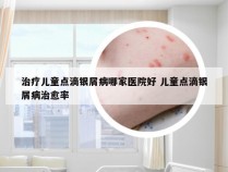 治疗儿童点滴银屑病哪家医院好 儿童点滴银屑病治愈率