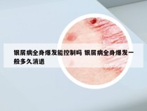 银屑病全身爆发能控制吗 银屑病全身爆发一般多久消退
