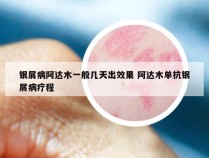 银屑病阿达木一般几天出效果 阿达木单抗银屑病疗程