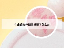 牛皮癣治疗期间感冒了怎么办