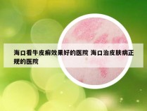 海口看牛皮癣效果好的医院 海口治皮肤病正规的医院
