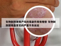 生物制剂使用产生的毒副作用有哪些 生物制剂使用最常见的严重不良反应